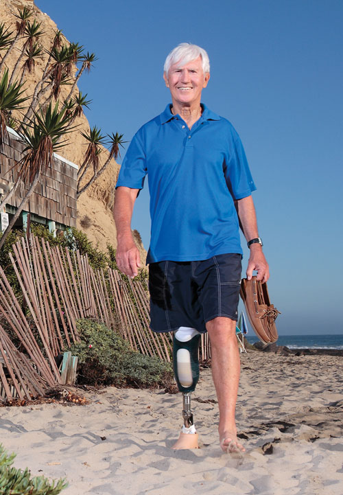 werner-de-beer-orthotist-prosthetist-fisio-theramy-rehabilitation-6a